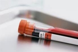 DWI Blood Test Case is Defended Using Phlebotomy Basics